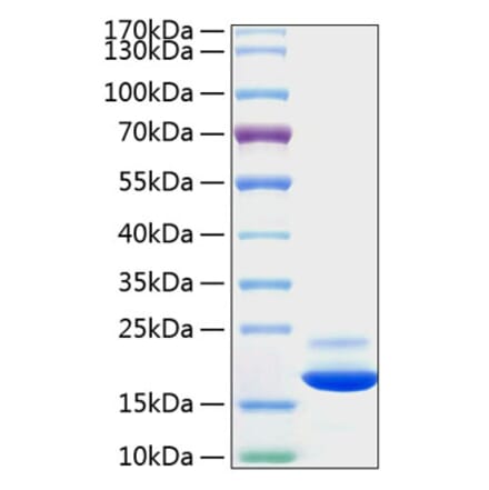 SDS-PAGE - Recombinant Mouse TNF-alpha Protein (C-terminal His Tag) (A331883) - Antibodies.com