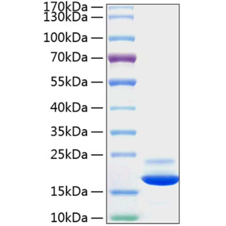 SDS-PAGE - Recombinant Mouse TNF-alpha Protein (C-terminal His Tag) (A331883) - Antibodies.com