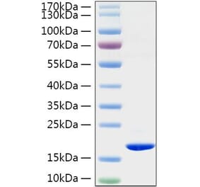 SDS-PAGE - Recombinant Rat TNF-alpha Protein (C-terminal His Tag) (A331884) - Antibodies.com