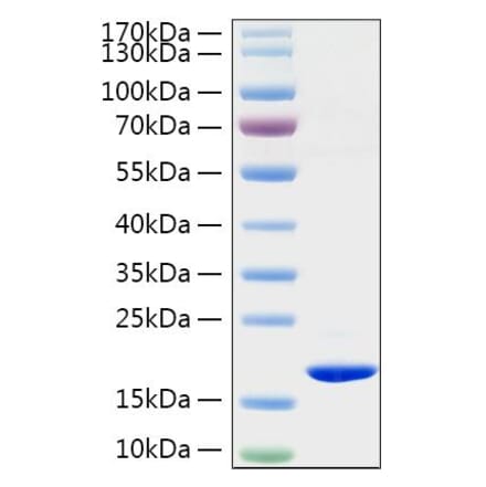 SDS-PAGE - Recombinant Rat TNF-alpha Protein (C-terminal His Tag) (A331884) - Antibodies.com