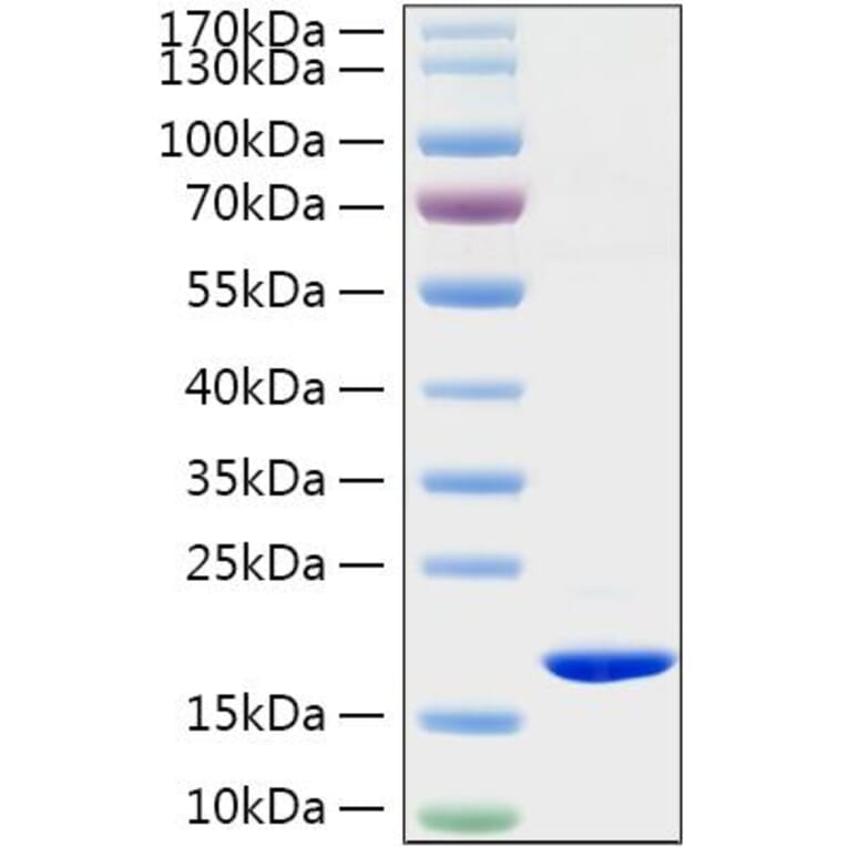 SDS-PAGE - Recombinant Rat TNF-alpha Protein (C-terminal His Tag) (A331884) - Antibodies.com