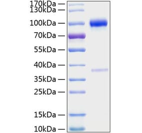 SDS-PAGE - Recombinant Mouse Osteoprotegerin Protein (C-terminal Human Fc and His Tag) (A331886) - Antibodies.com
