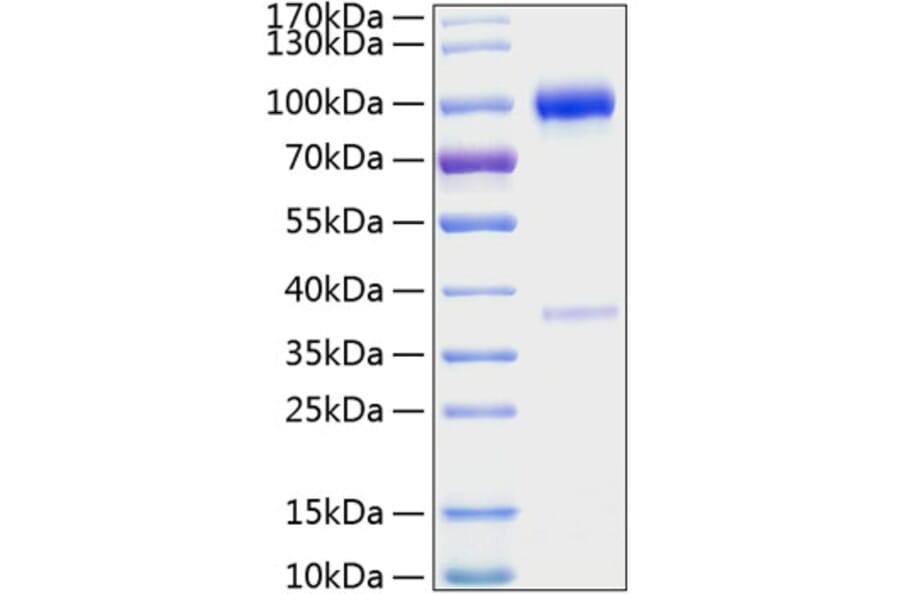 SDS-PAGE - Recombinant Mouse Osteoprotegerin Protein (C-terminal Human Fc and His Tag) (A331886) - Antibodies.com