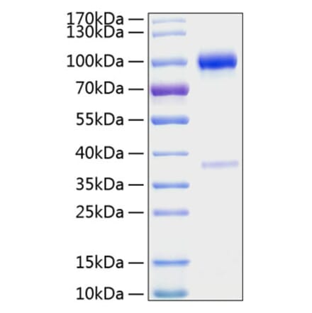 SDS-PAGE - Recombinant Mouse Osteoprotegerin Protein (C-terminal Human Fc and His Tag) (A331886) - Antibodies.com