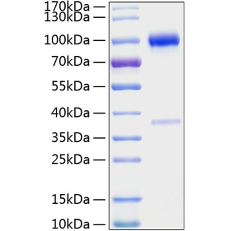SDS-PAGE - Recombinant Mouse Osteoprotegerin Protein (C-terminal Human Fc and His Tag) (A331886) - Antibodies.com