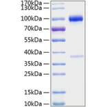 SDS-PAGE - Recombinant Mouse Osteoprotegerin Protein (C-terminal Human Fc and His Tag) (A331886) - Antibodies.com