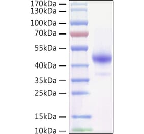 SDS-PAGE - Recombinant Mouse TNFRSF13C Protein (C-terminal Human Fc and Avi Tag) (A331887) - Antibodies.com