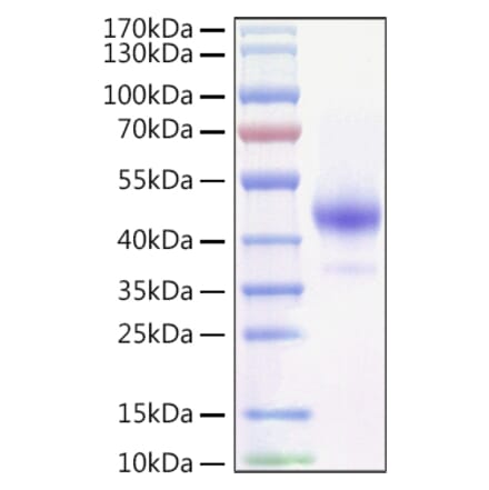 SDS-PAGE - Recombinant Mouse TNFRSF13C Protein (C-terminal Human Fc and Avi Tag) (A331887) - Antibodies.com