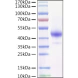 SDS-PAGE - Recombinant Mouse TNFRSF13C Protein (C-terminal Human Fc and Avi Tag) (A331887) - Antibodies.com