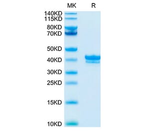 Tris-Bis PAGE - Recombinant Cynomolgus macaque BCMA Protein (C-terminal Human Fc Tag) (A331888) - Antibodies.com