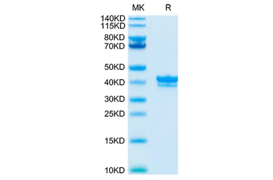 Tris-Bis PAGE - Recombinant Cynomolgus macaque BCMA Protein (C-terminal Human Fc Tag) (A331888) - Antibodies.com