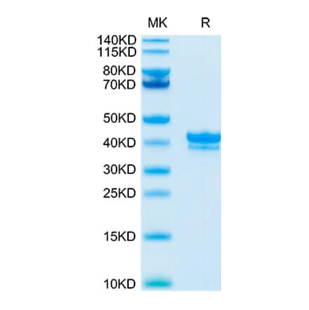 Tris-Bis PAGE - Recombinant Cynomolgus macaque BCMA Protein (C-terminal Human Fc Tag) (A331888) - Antibodies.com