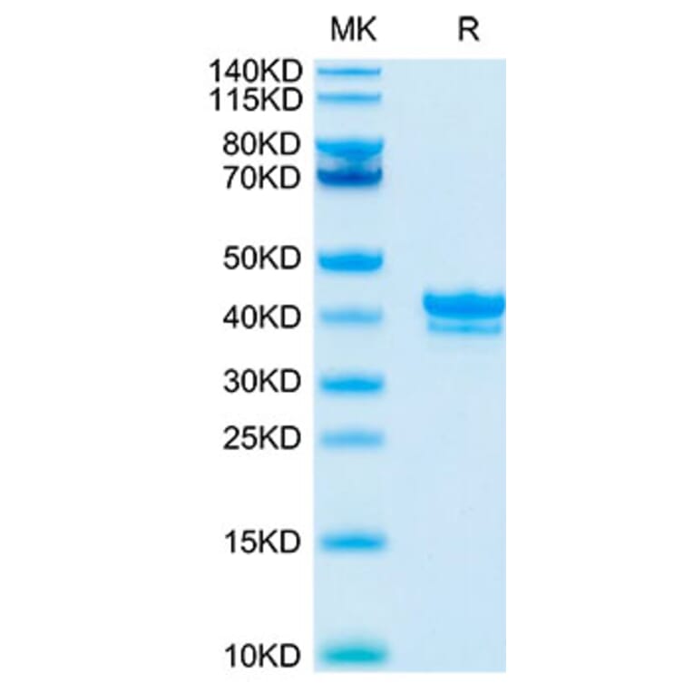 Tris-Bis PAGE - Recombinant Cynomolgus macaque BCMA Protein (C-terminal Human Fc Tag) (A331888) - Antibodies.com