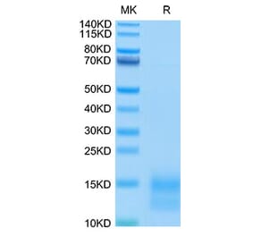 Tris-Bis PAGE - Recombinant Mouse BCMA Protein (C-terminal His and Avi Tag) (A331889) - Antibodies.com