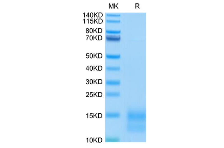 Tris-Bis PAGE - Recombinant Mouse BCMA Protein (C-terminal His and Avi Tag) (A331889) - Antibodies.com
