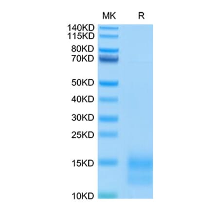 Tris-Bis PAGE - Recombinant Mouse BCMA Protein (C-terminal His and Avi Tag) (A331889) - Antibodies.com