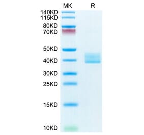 Tris-Bis PAGE - Recombinant Mouse BCMA Protein (C-terminal Human Fc Tag) (A331890) - Antibodies.com