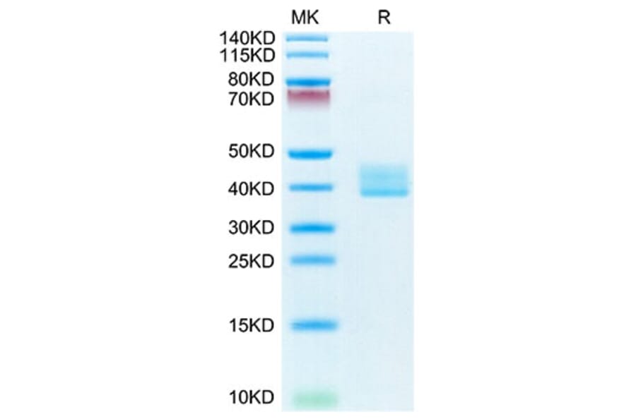 Tris-Bis PAGE - Recombinant Mouse BCMA Protein (C-terminal Human Fc Tag) (A331890) - Antibodies.com
