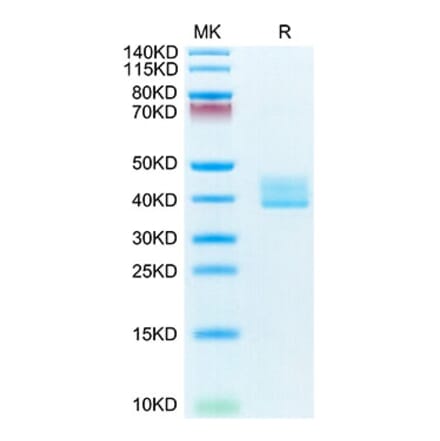 Tris-Bis PAGE - Recombinant Mouse BCMA Protein (C-terminal Human Fc Tag) (A331890) - Antibodies.com