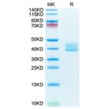 Tris-Bis PAGE - Recombinant Mouse BCMA Protein (C-terminal Human Fc Tag) (A331890) - Antibodies.com