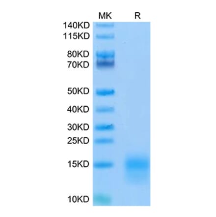 Tris-Bis PAGE - Recombinant Mouse BCMA Protein (Biotin) (C-terminal His and Avi Tag) (A331891) - Antibodies.com