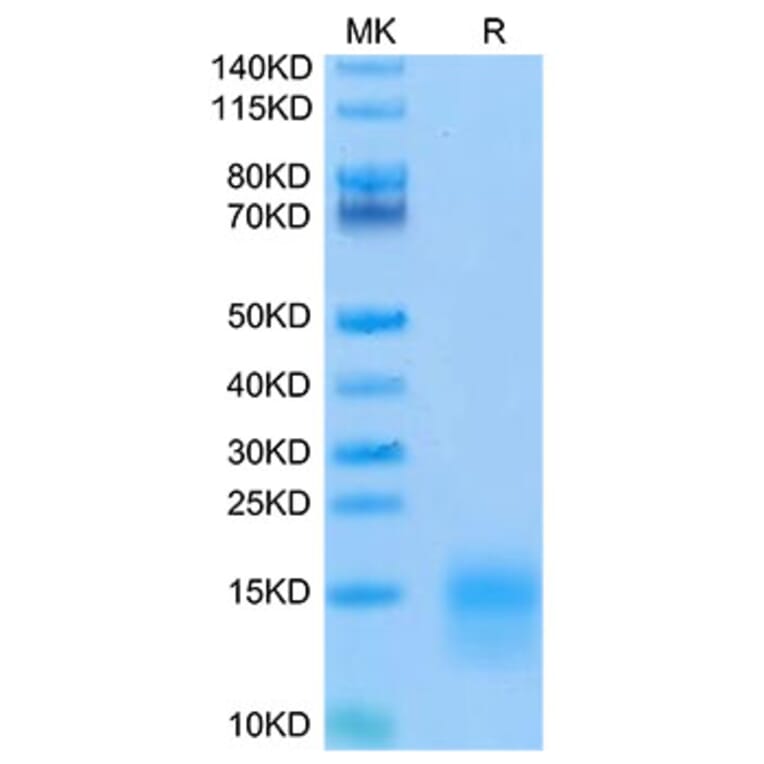 Tris-Bis PAGE - Recombinant Mouse BCMA Protein (Biotin) (C-terminal His and Avi Tag) (A331891) - Antibodies.com