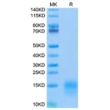Tris-Bis PAGE - Recombinant Mouse BCMA Protein (Biotin) (C-terminal His and Avi Tag) (A331891) - Antibodies.com