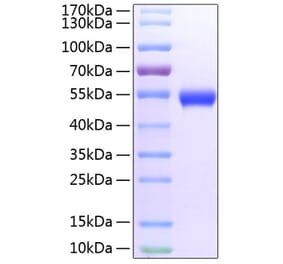 SDS-PAGE - Recombinant Mouse GITR Protein (C-terminal Fc and His Tag) (A331892) - Antibodies.com