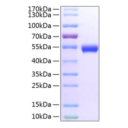 SDS-PAGE - Recombinant Mouse GITR Protein (C-terminal Fc and His Tag) (A331892) - Antibodies.com