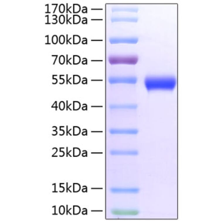 SDS-PAGE - Recombinant Mouse GITR Protein (C-terminal Fc and His Tag) (A331892) - Antibodies.com