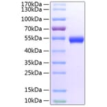 SDS-PAGE - Recombinant Mouse GITR Protein (C-terminal Fc and His Tag) (A331892) - Antibodies.com