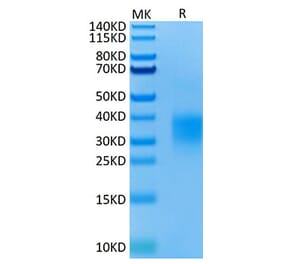 Tris-Bis PAGE - Recombinant Mouse GITR Protein (C-terminal His Tag) (A331893) - Antibodies.com