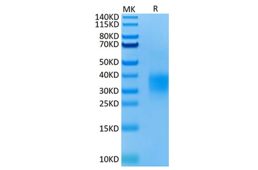 Tris-Bis PAGE - Recombinant Mouse GITR Protein (C-terminal His Tag) (A331893) - Antibodies.com