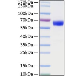 SDS-PAGE - Recombinant Mouse TNFRSF1A Protein (C-terminal Human Fc and His Tag) (A331894) - Antibodies.com