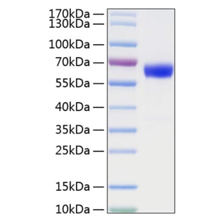 SDS-PAGE - Recombinant Mouse TNFRSF1A Protein (C-terminal Human Fc and His Tag) (A331894) - Antibodies.com