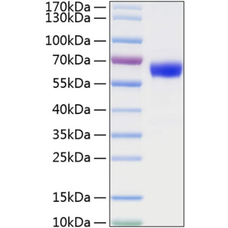 SDS-PAGE - Recombinant Mouse TNFRSF1A Protein (C-terminal Human Fc and His Tag) (A331894) - Antibodies.com