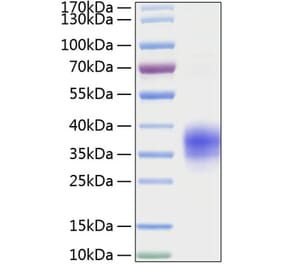 SDS-PAGE - Recombinant Mouse TNFRSF1A Protein (C-terminal His Tag) (A331895) - Antibodies.com