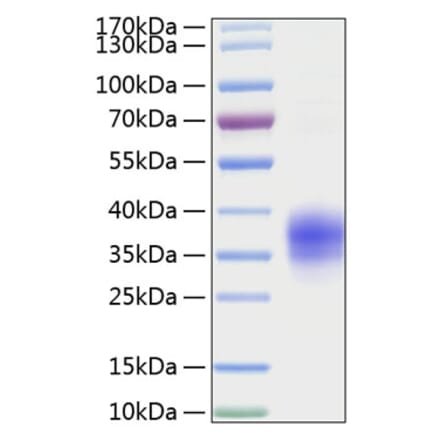 SDS-PAGE - Recombinant Mouse TNFRSF1A Protein (C-terminal His Tag) (A331895) - Antibodies.com