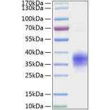 SDS-PAGE - Recombinant Mouse TNFRSF1A Protein (C-terminal His Tag) (A331895) - Antibodies.com