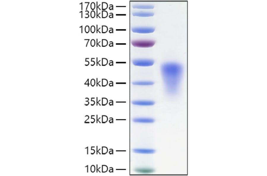 SDS-PAGE - Recombinant Mouse TNFRSF1B Protein (C-terminal His Tag) (A331896) - Antibodies.com