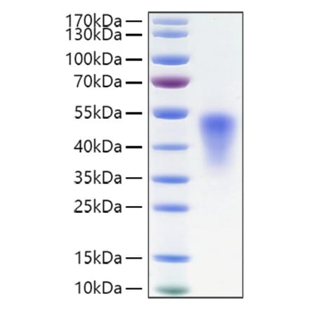 SDS-PAGE - Recombinant Mouse TNFRSF1B Protein (C-terminal His Tag) (A331896) - Antibodies.com