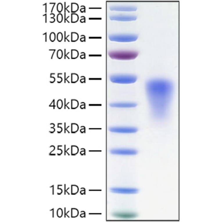 SDS-PAGE - Recombinant Mouse TNFRSF1B Protein (C-terminal His Tag) (A331896) - Antibodies.com