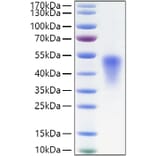 SDS-PAGE - Recombinant Mouse TNFRSF1B Protein (C-terminal His Tag) (A331896) - Antibodies.com
