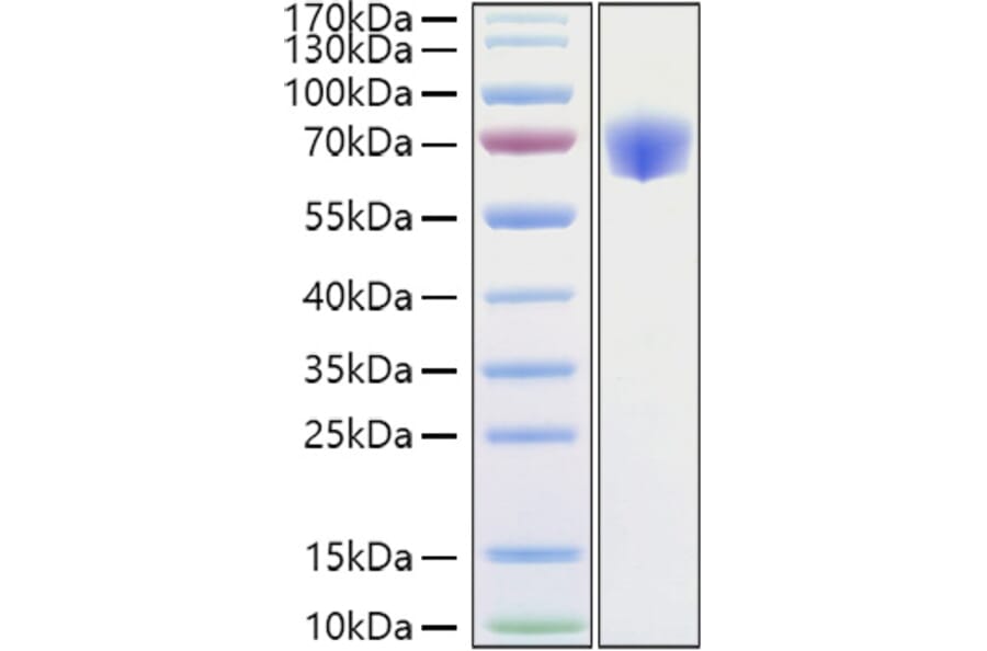SDS-PAGE - Recombinant Mouse TNFRSF1B Protein (C-terminal Human Fc Tag) (A331897) - Antibodies.com