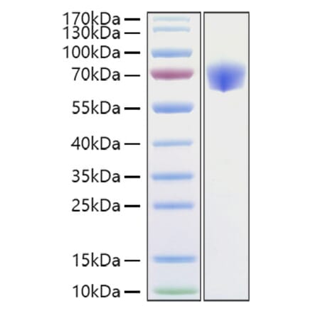 SDS-PAGE - Recombinant Mouse TNFRSF1B Protein (C-terminal Human Fc Tag) (A331897) - Antibodies.com