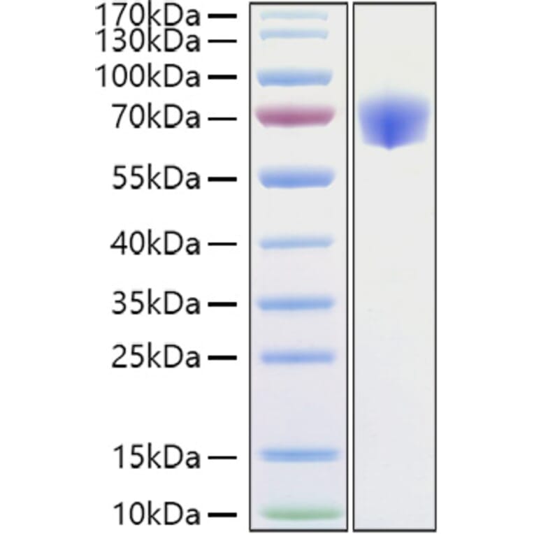 SDS-PAGE - Recombinant Mouse TNFRSF1B Protein (C-terminal Human Fc Tag) (A331897) - Antibodies.com