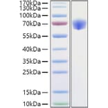 SDS-PAGE - Recombinant Mouse TNFRSF1B Protein (C-terminal Human Fc Tag) (A331897) - Antibodies.com