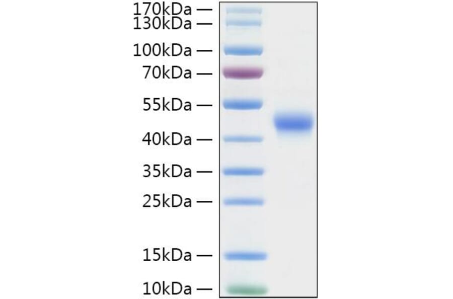 SDS-PAGE - Recombinant Mouse TNFRSF4 Protein (C-terminal His Tag) (A331898) - Antibodies.com