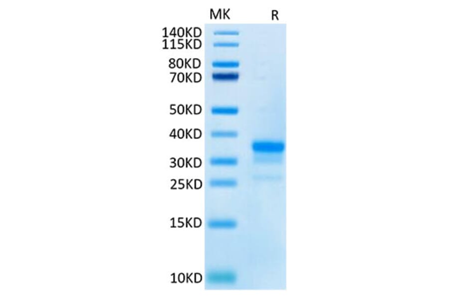 Tris-Bis PAGE - Recombinant Cynomolgus macaque CD40 Protein (C-terminal His Tag) (A331899) - Antibodies.com