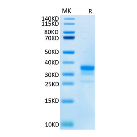 Tris-Bis PAGE - Recombinant Cynomolgus macaque CD40 Protein (C-terminal His Tag) (A331899) - Antibodies.com